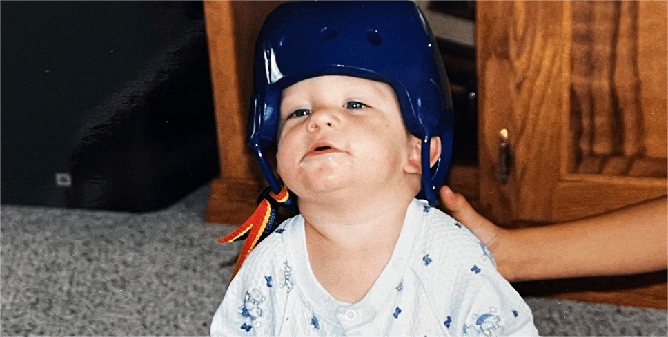 Rex Herald, paciente con hemofilia A, de bebé usando un casco de rugby azul.